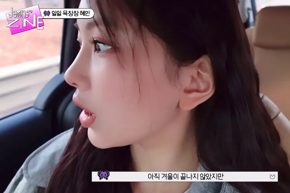 저도 요새 인중 정병 오져요9