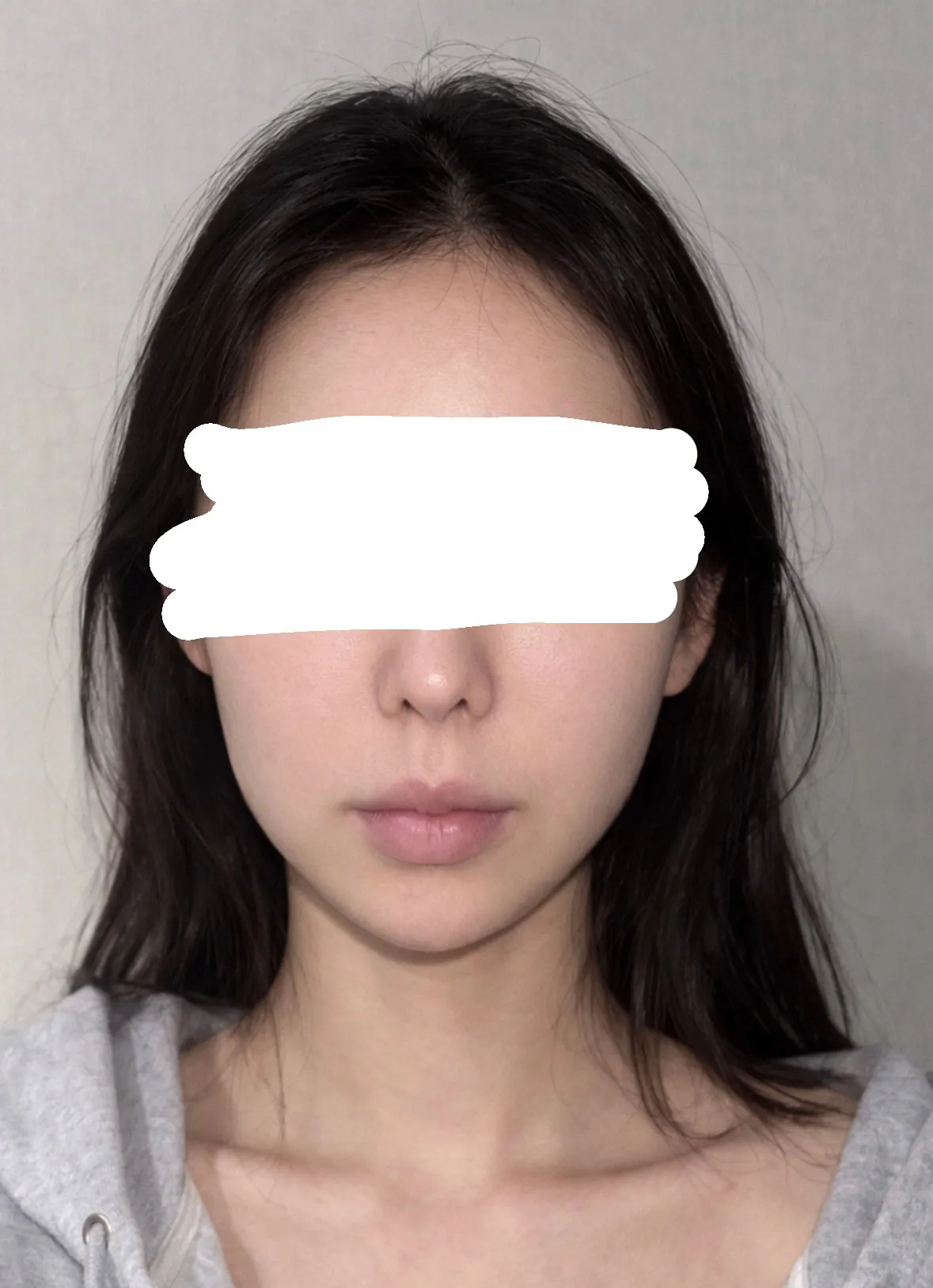 언니들 저 성형 더 할까요2