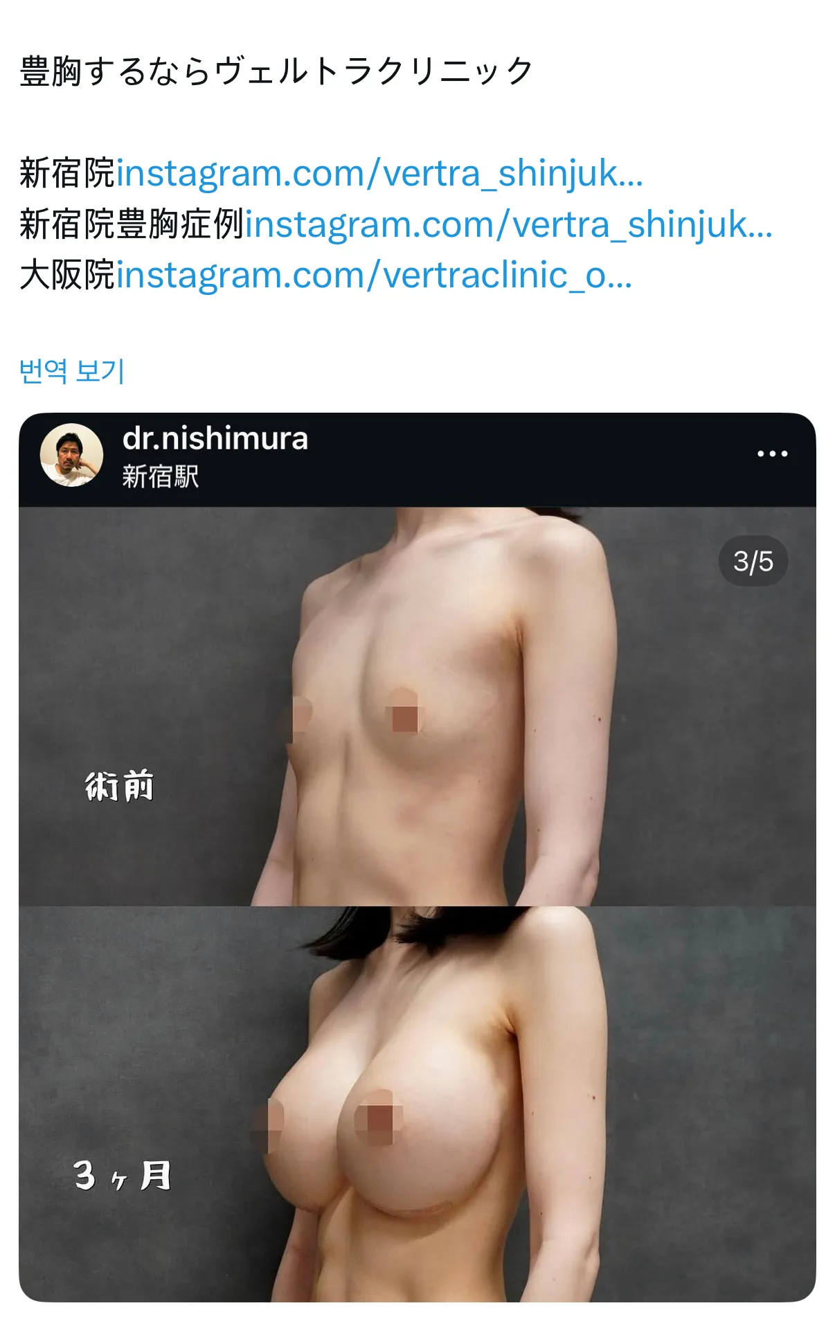 ㅁㅊ 이게 몇 cc야...