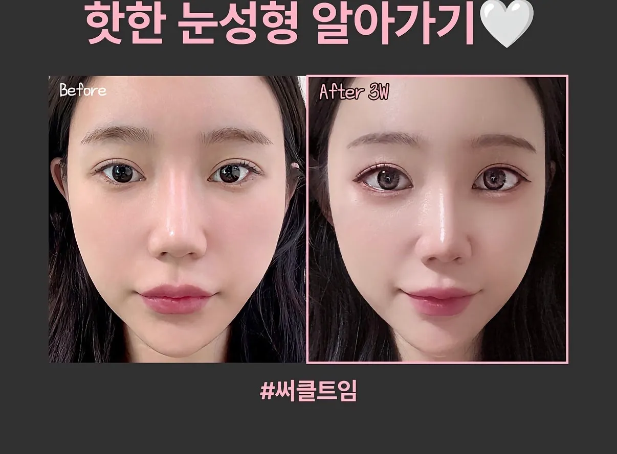 저만 미감 이상하다고 느끼나요