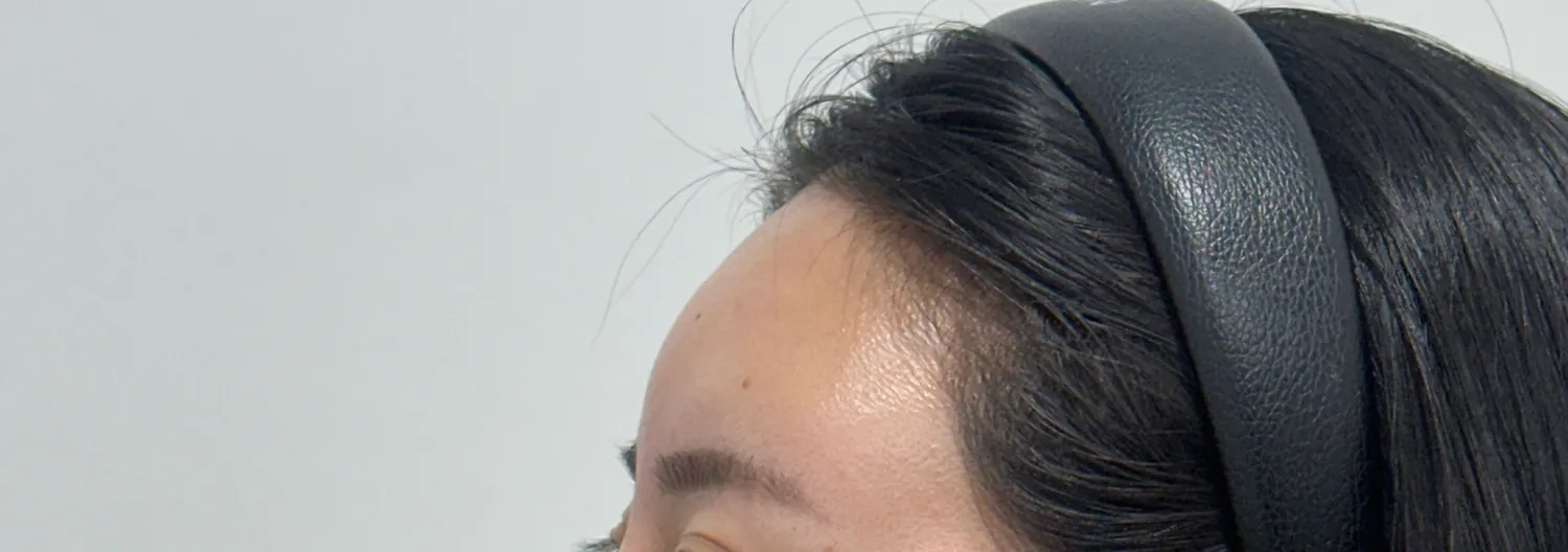 이마필러맞은지 일년다되가는데