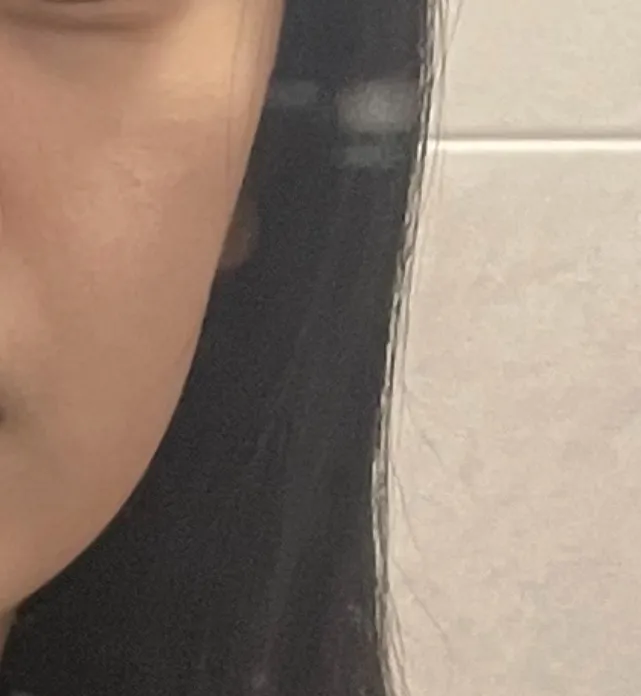 22살인데 얼굴 맛 갔는데2