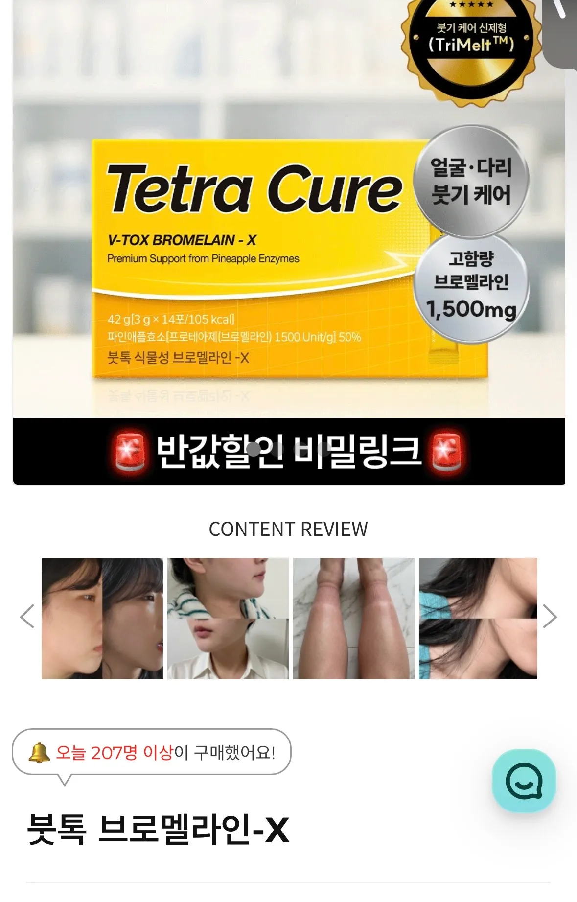 붓기