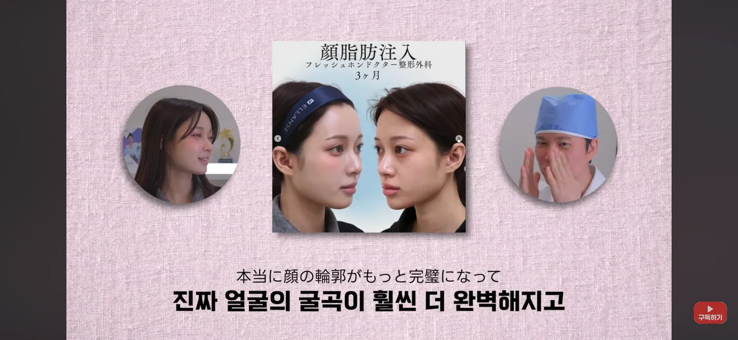 이 일본인 얼굴지이 개잘됏다2