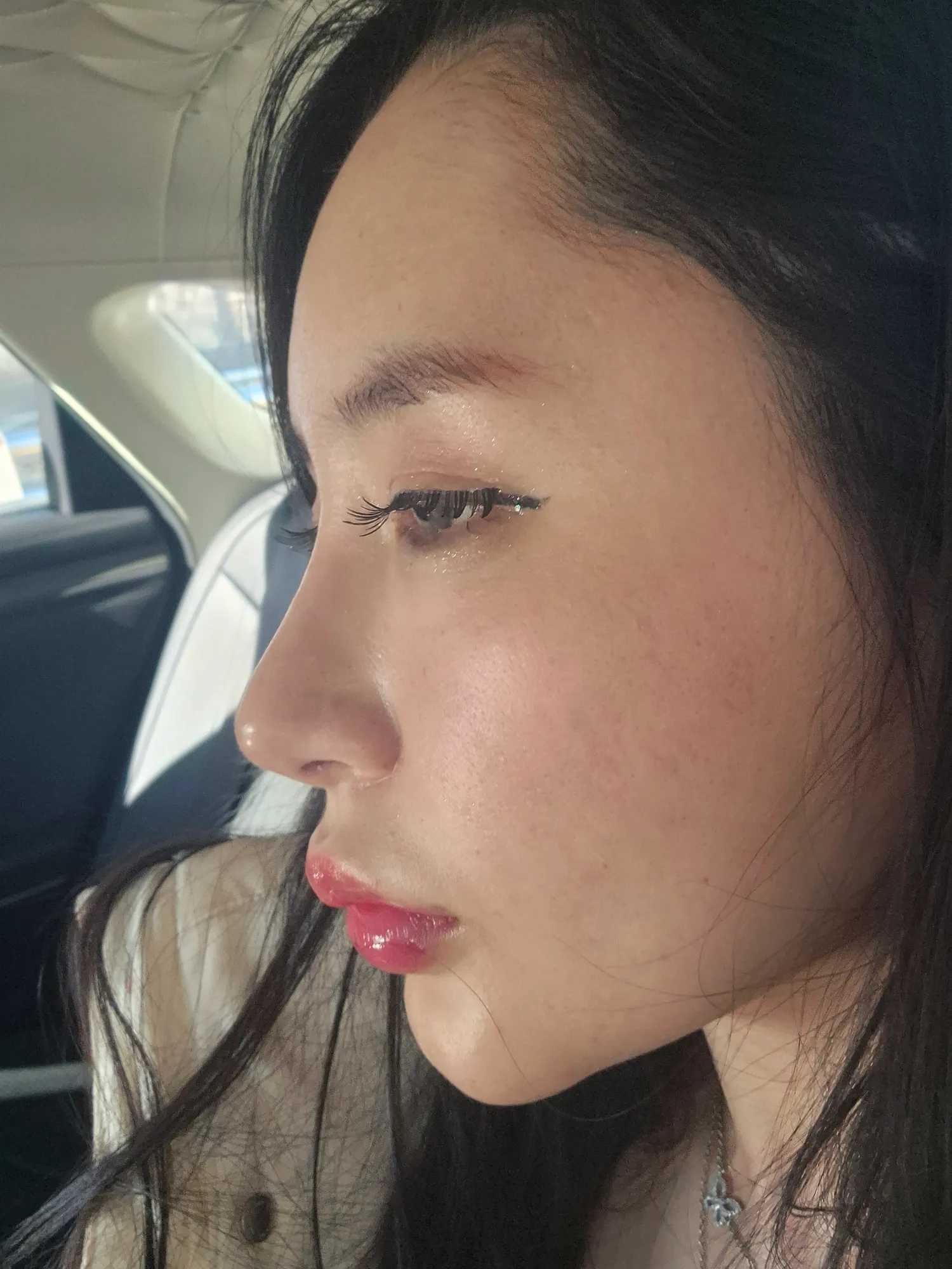 서울에 코수술한 코위에 필러놔주는병원 댓글