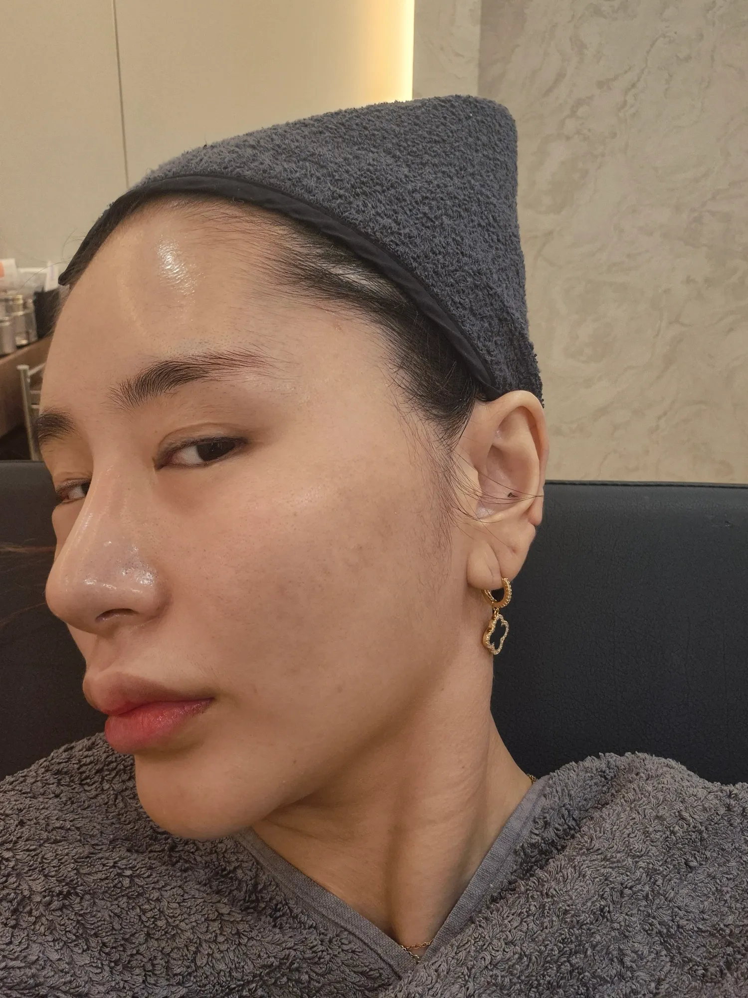 서울에 코수술한 코위에 필러놔주는병원 댓글 3