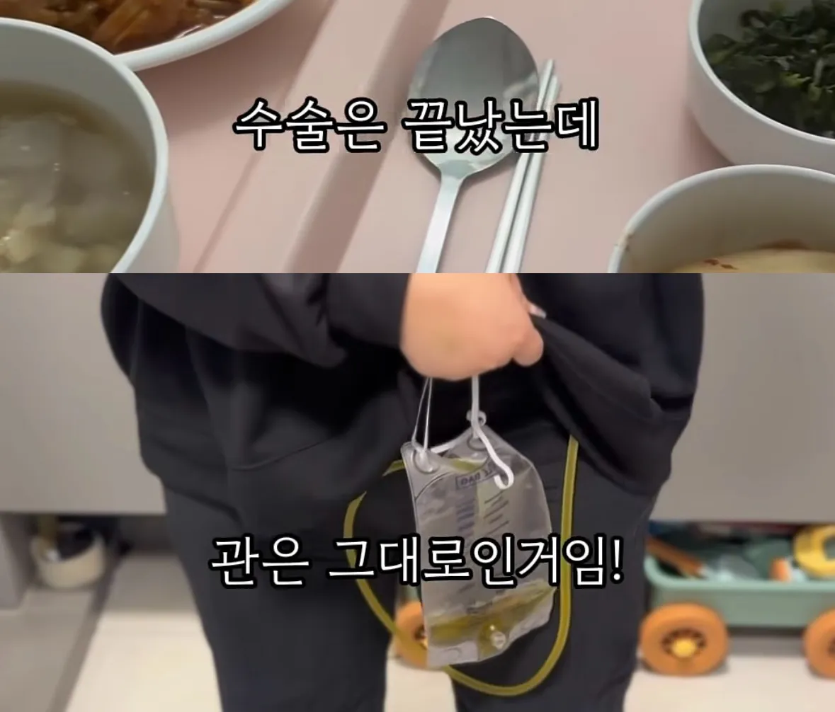 위고비 마운자로 맞고 배에 구멍난 사람4