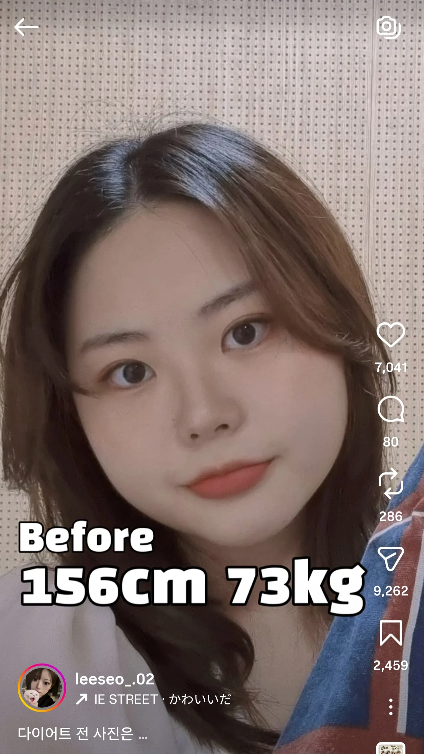 이거보고 마운자로 꽂으러감