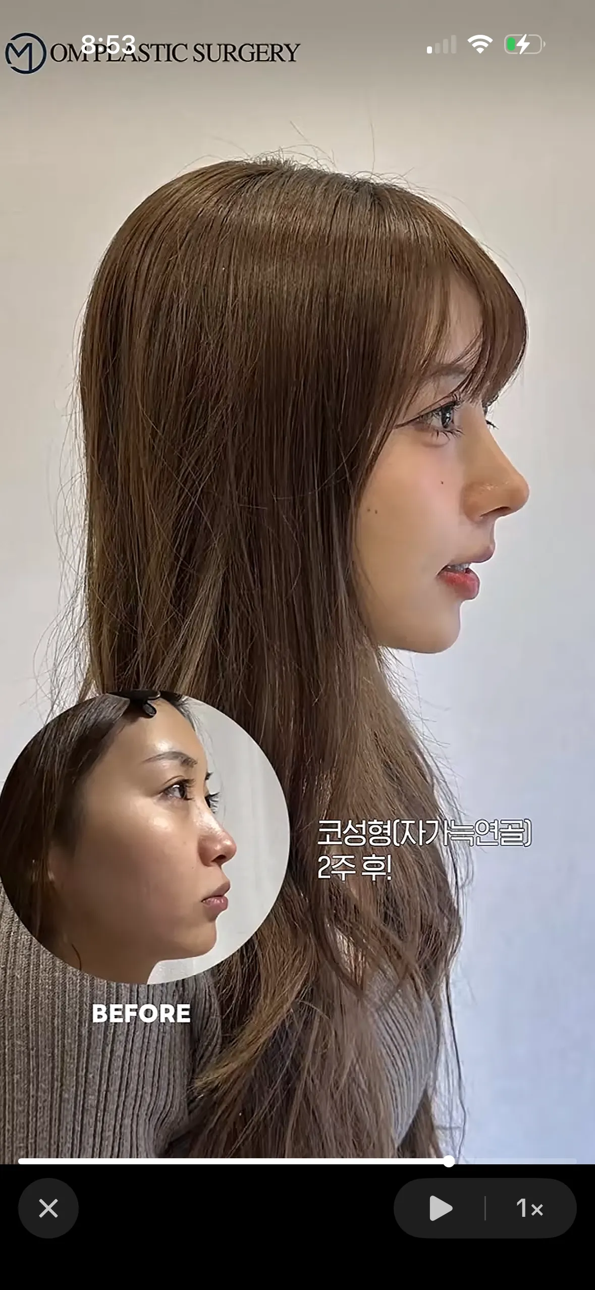 이런코 자려인가요?2