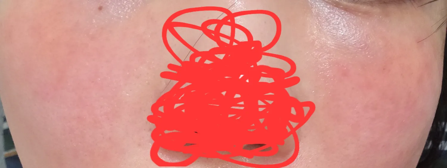 피부샵 잘못다니고