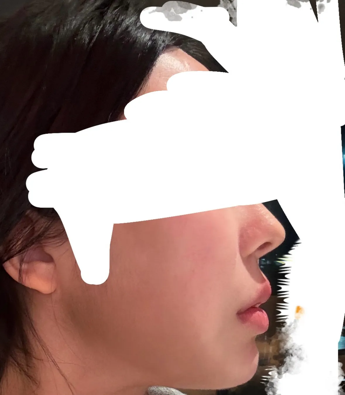 양악 할말