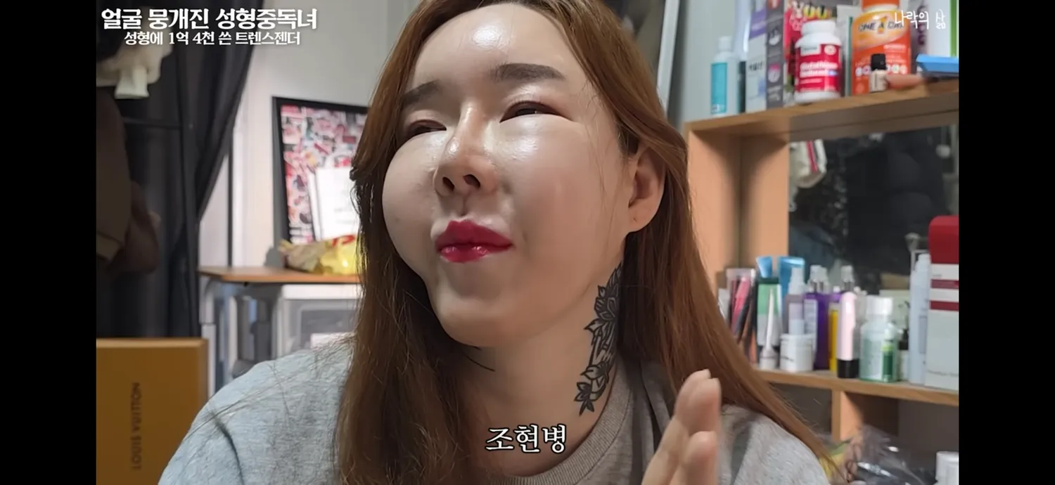 성형으로 망가진 사람들 보면 무서워요...