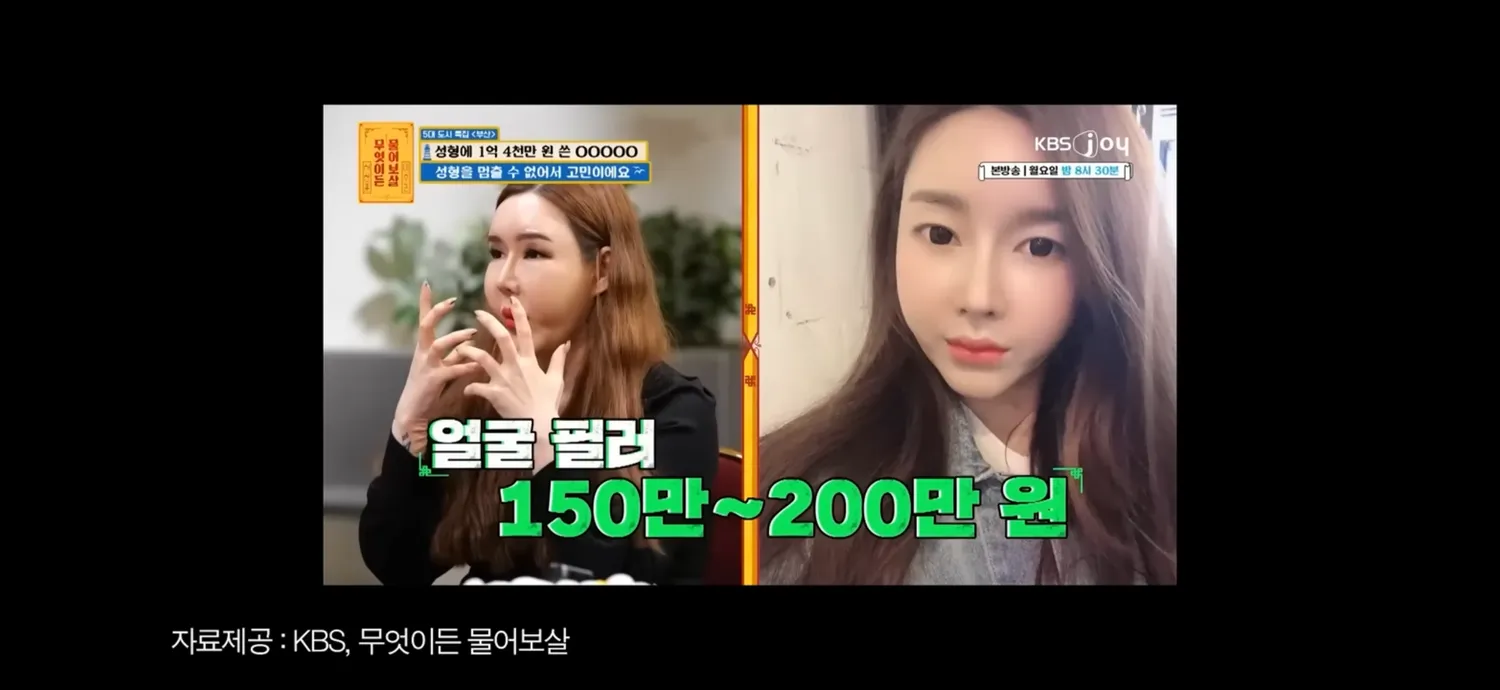 성형으로 망가진 사람들 보면 무서워요...2