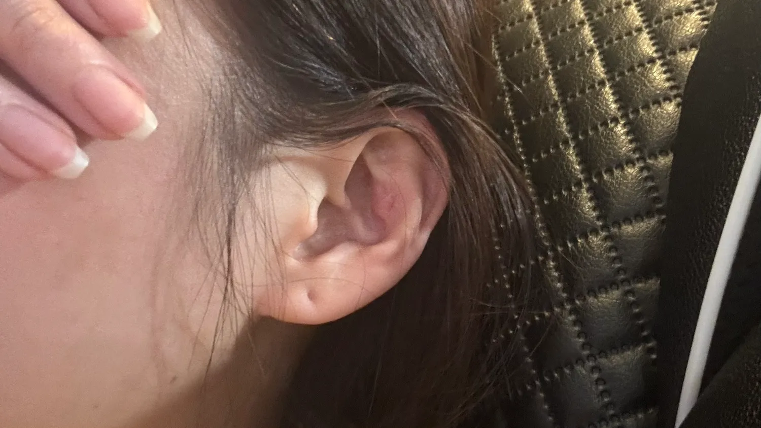 옛날에 코 수술 하구 귀 연골 뗀 곳