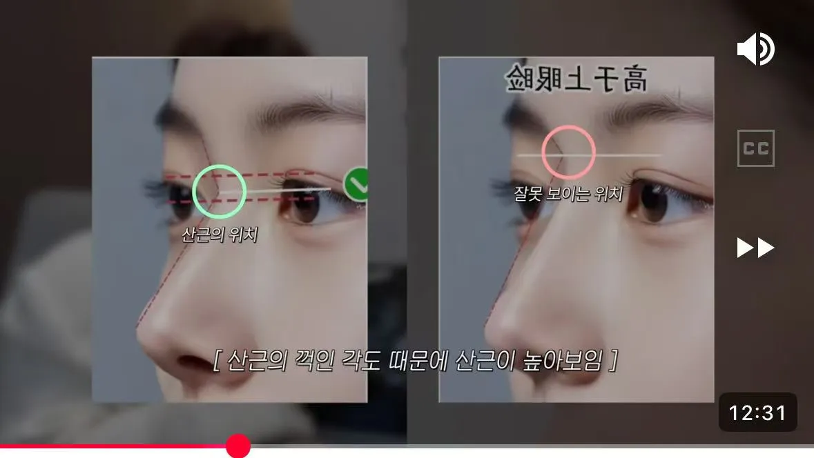 이런코 어때여?ㅠㅠ2