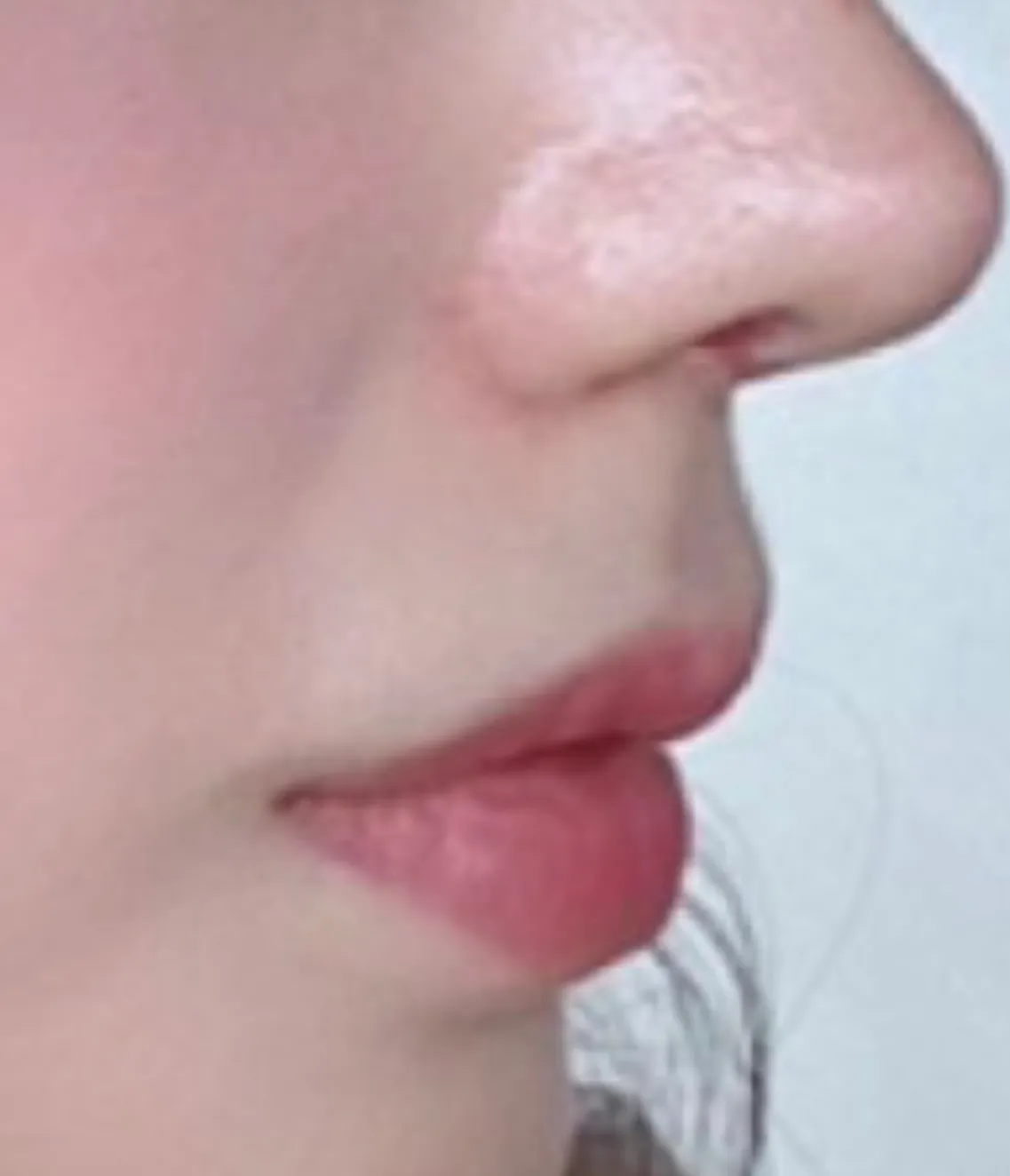 인중이요