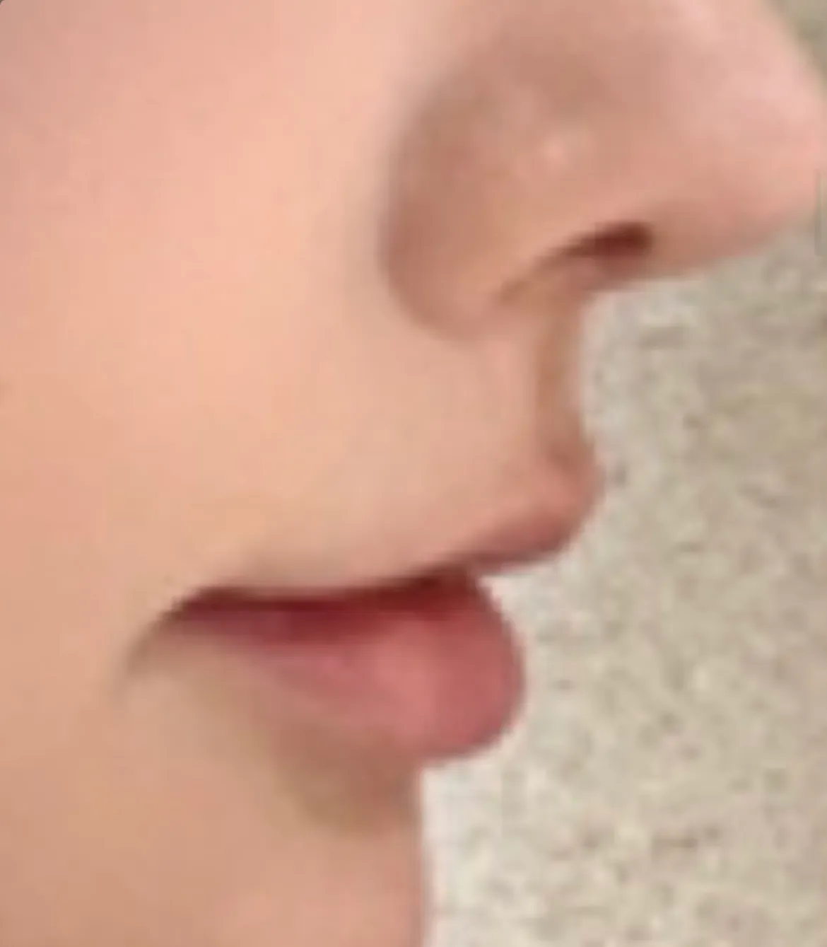 인중이요2