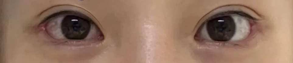 뒷밑 한번만 봐주세용 댓글