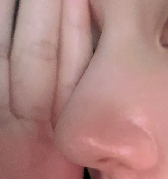 코 3개월차