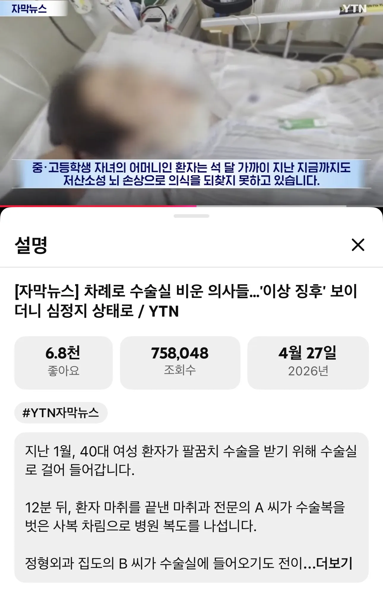 성형수술 함부로 못하겟어요 ㅠ갑자기 무서움