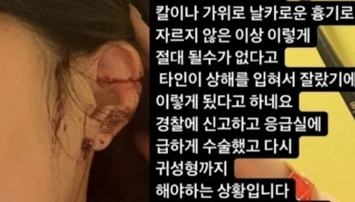 헐 클럽에서 귀 잘렸대요 댓글