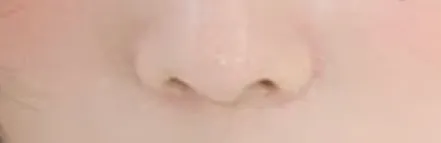 콧구멍