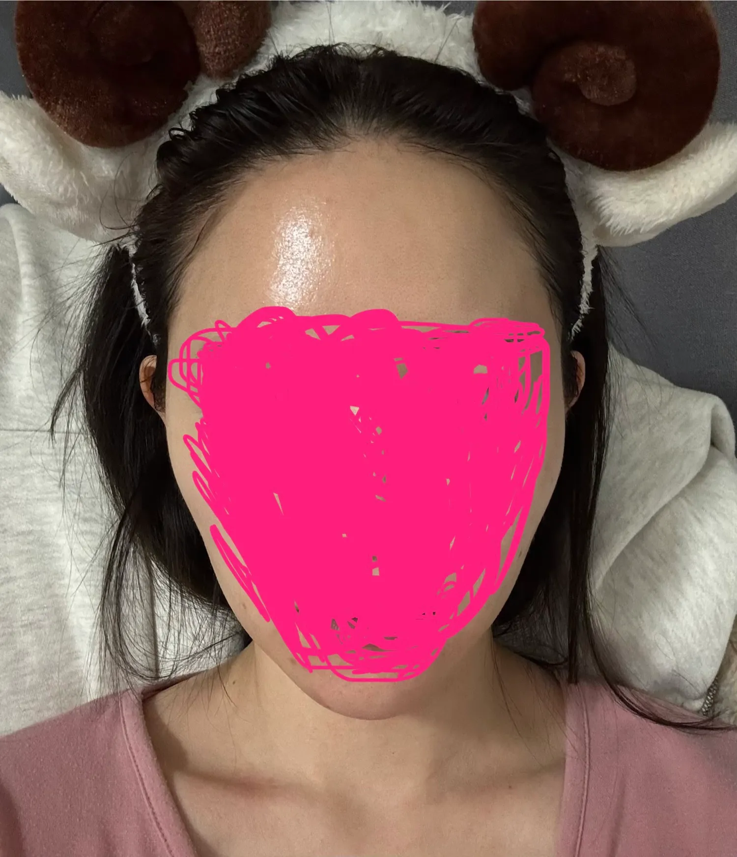 언니들 옆볼필러 잘하는곳 추천해주세요