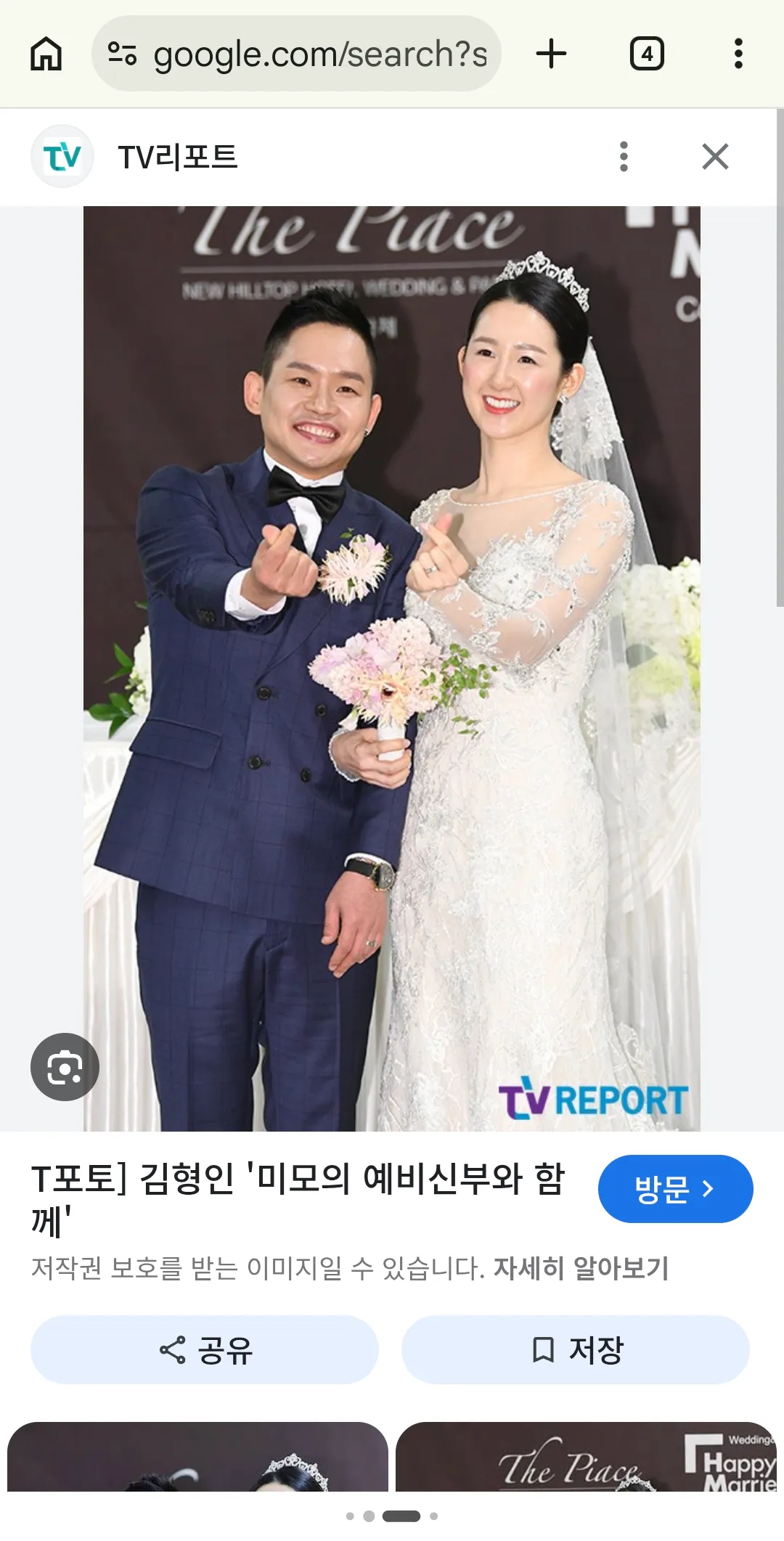 양악까지 다돌렸다는데 못생기면안되는구나3