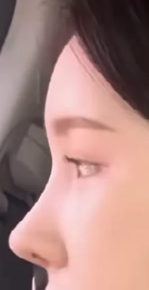 코 이런 라인이면