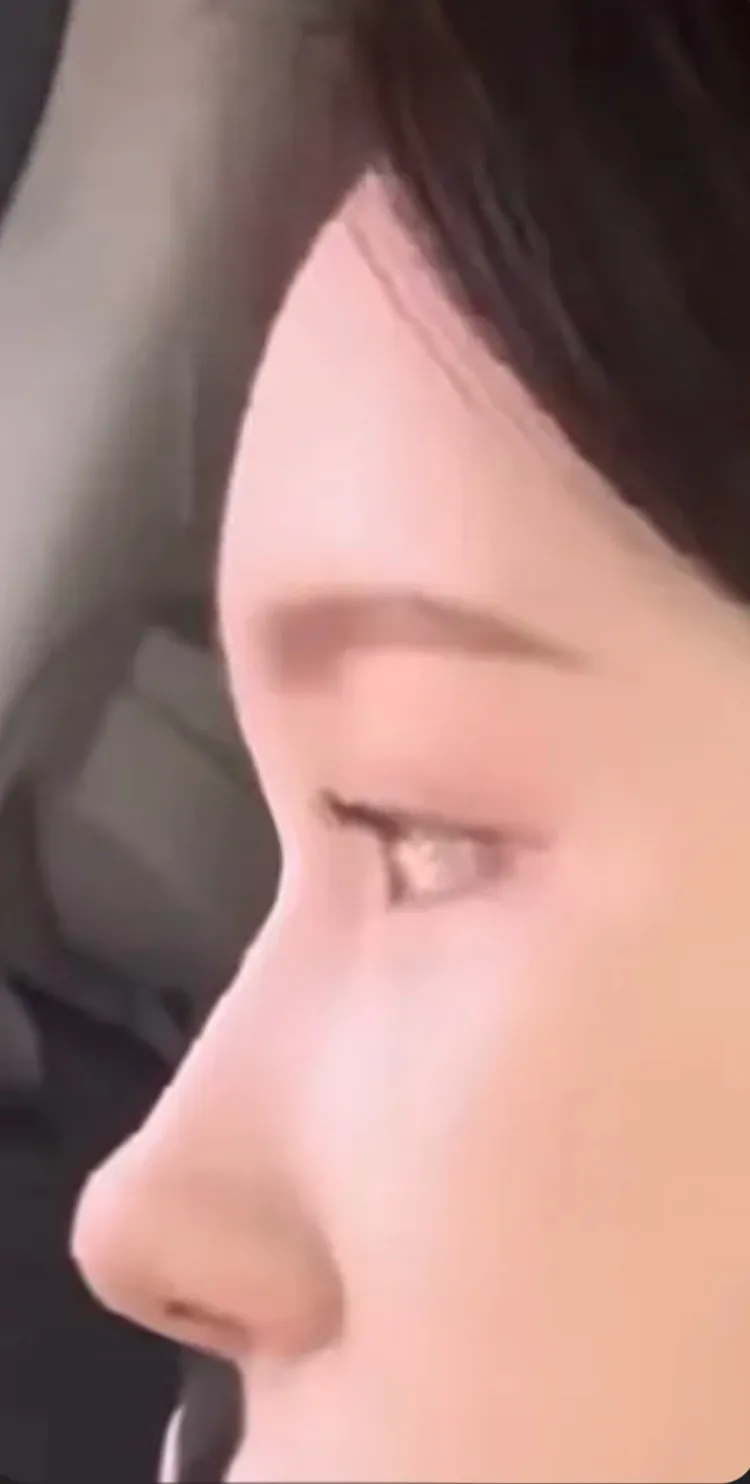 코 이런 라인이면 댓글