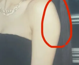 지흡이 답인가여