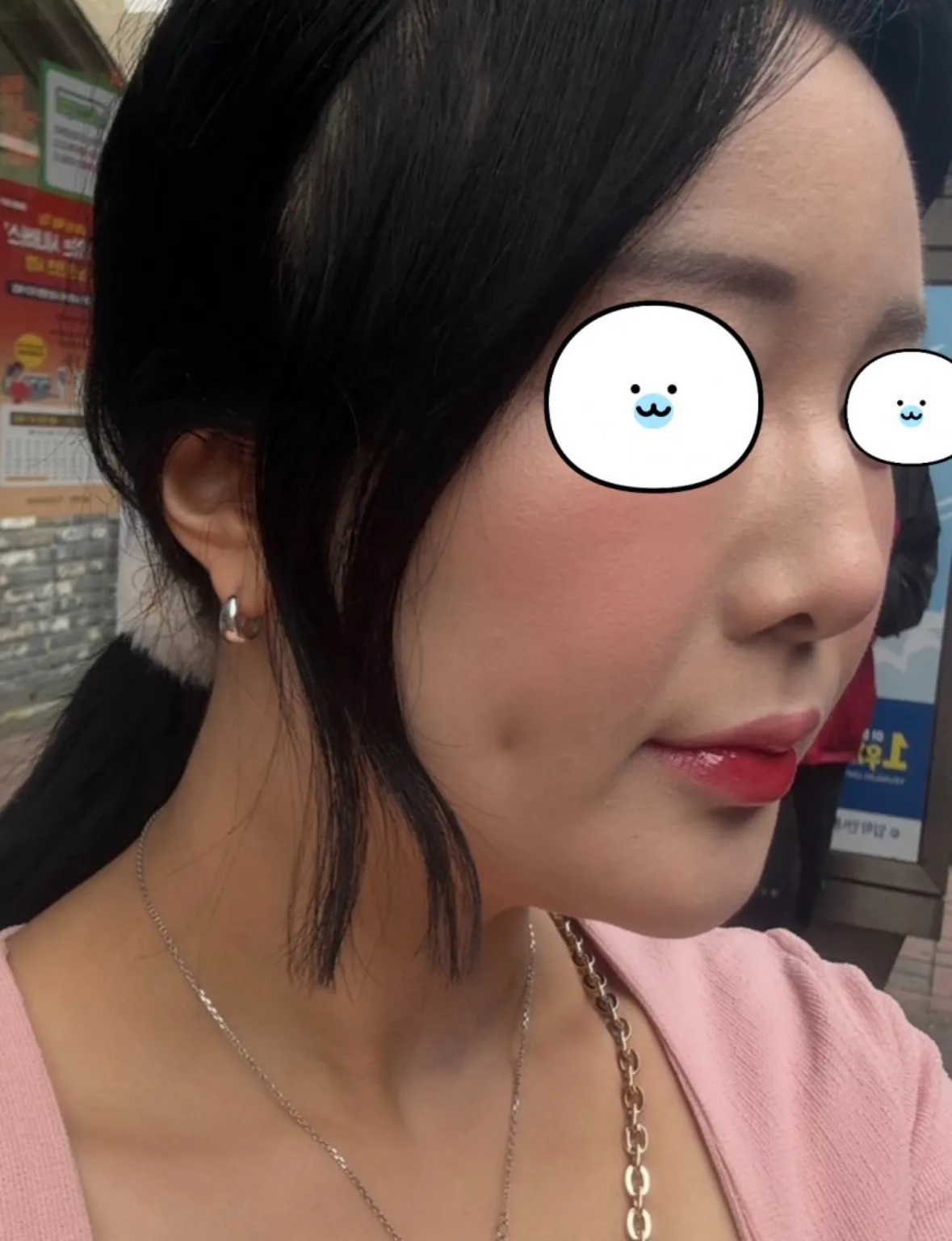 코수술 잘됐나여?