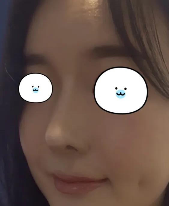 코수술 잘됐나여?2