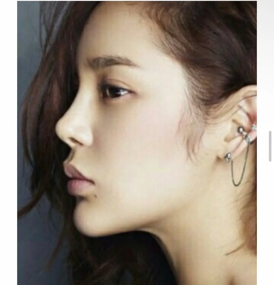 턱끝필러