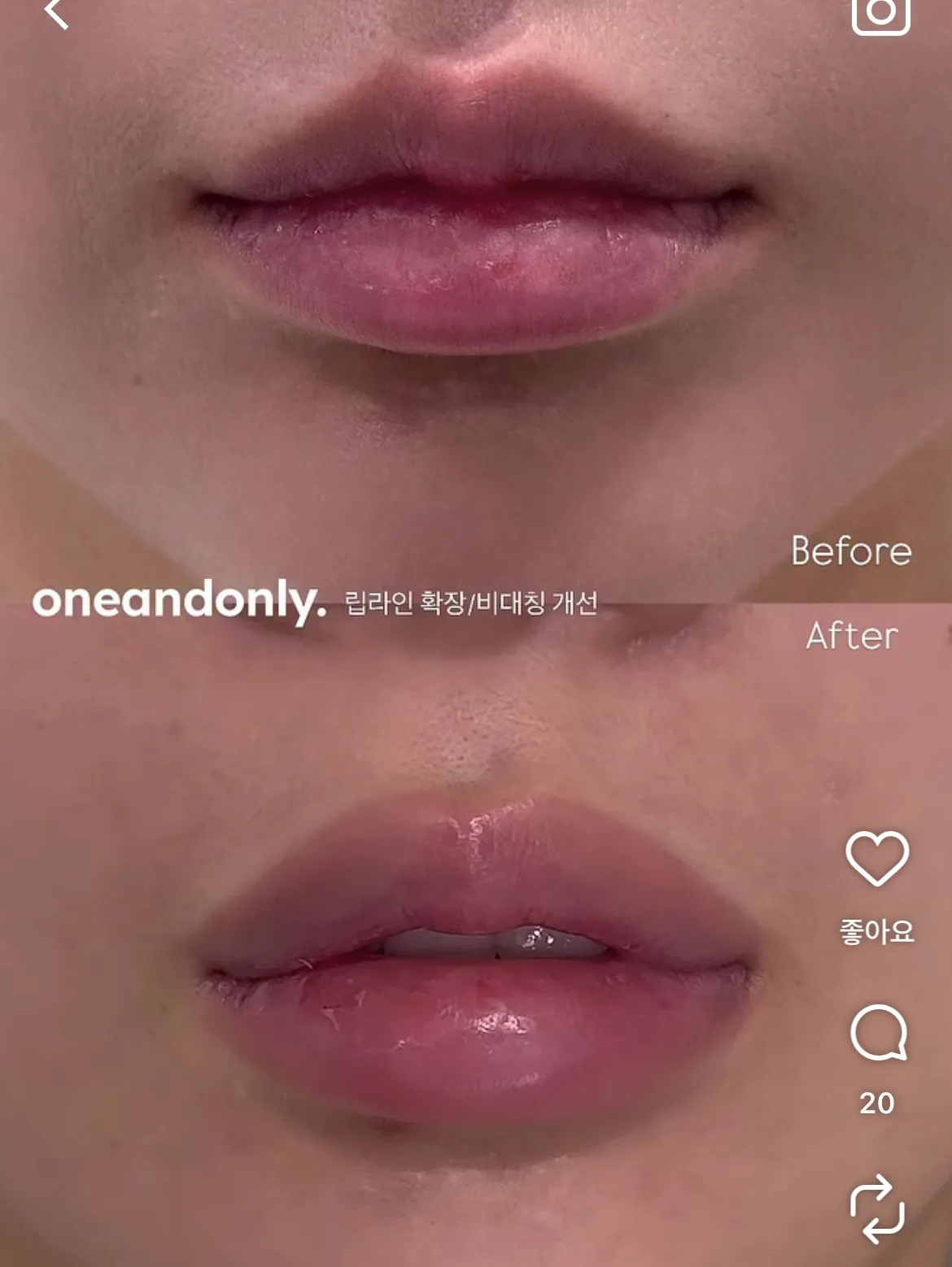 이거 받아 본 언니들 잇아여?2