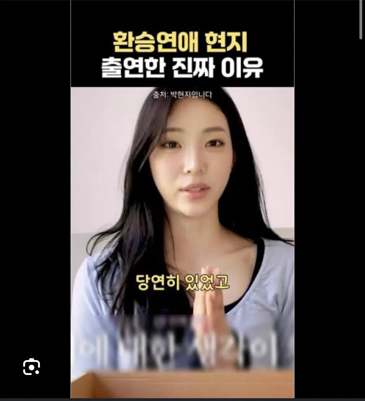 현지 하관 안예쁜거에요?3