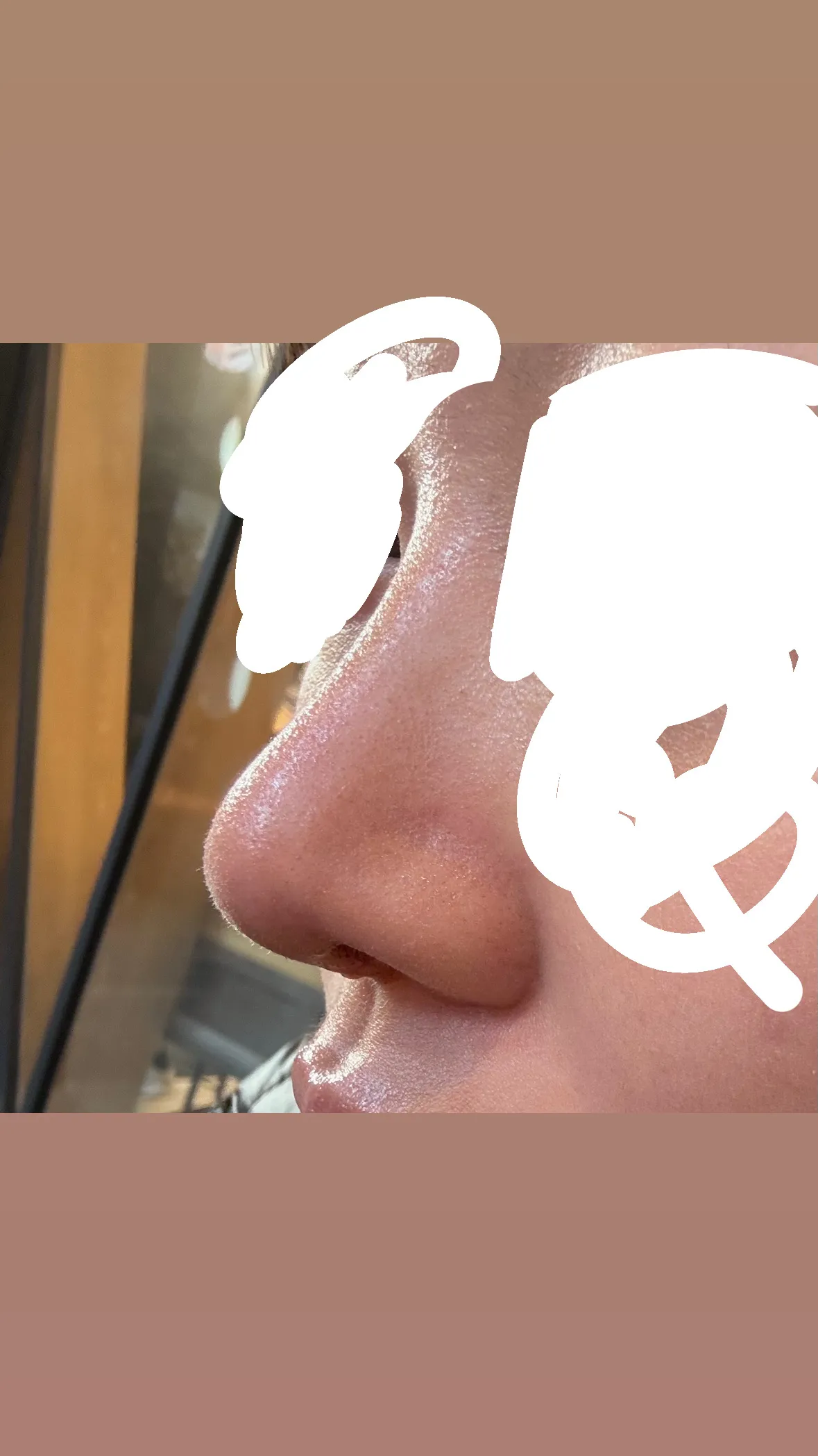 언니들 저 코 봐주실수있나요