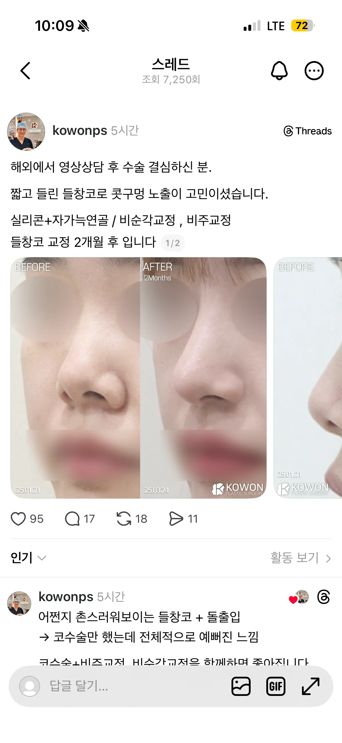 개예뿌당