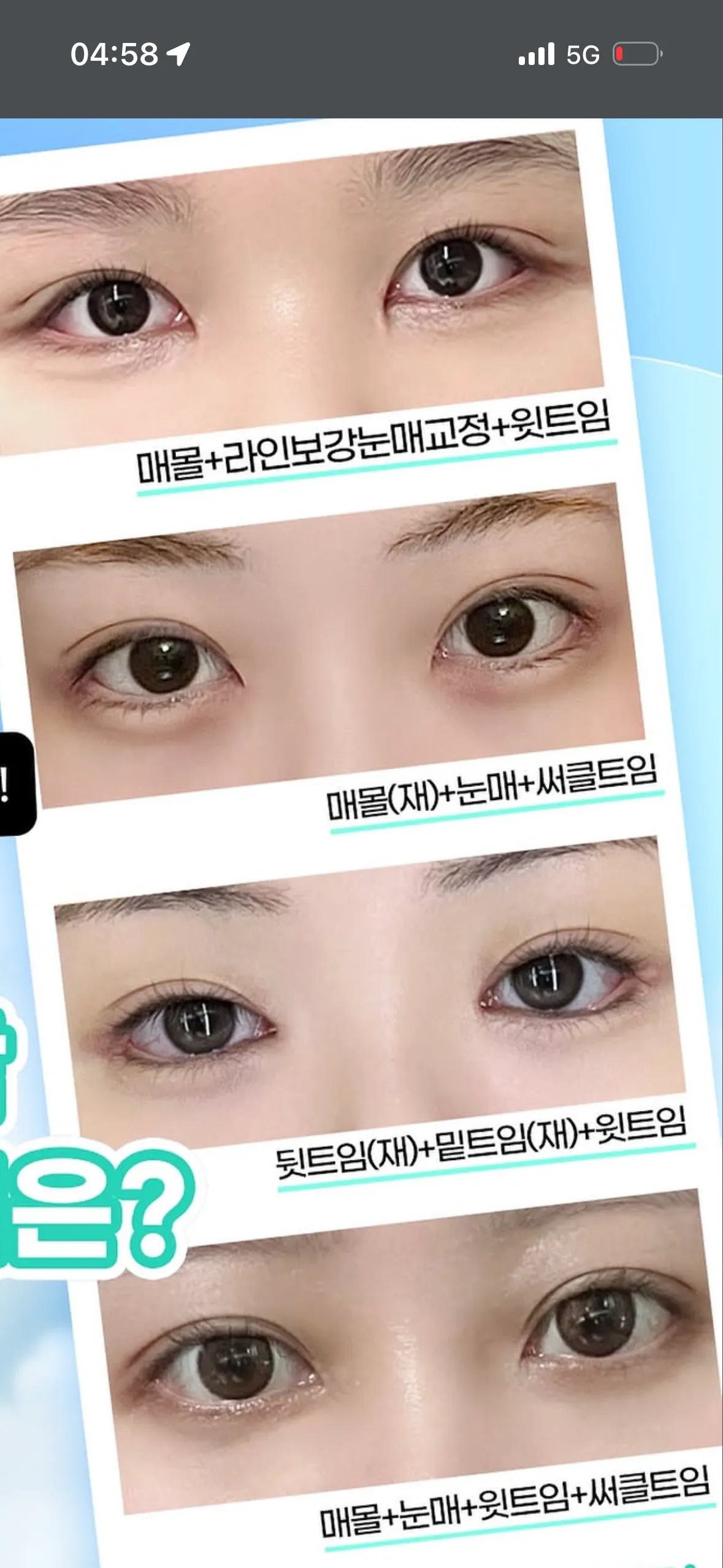 트임 가족한테 숨길수잇나요?