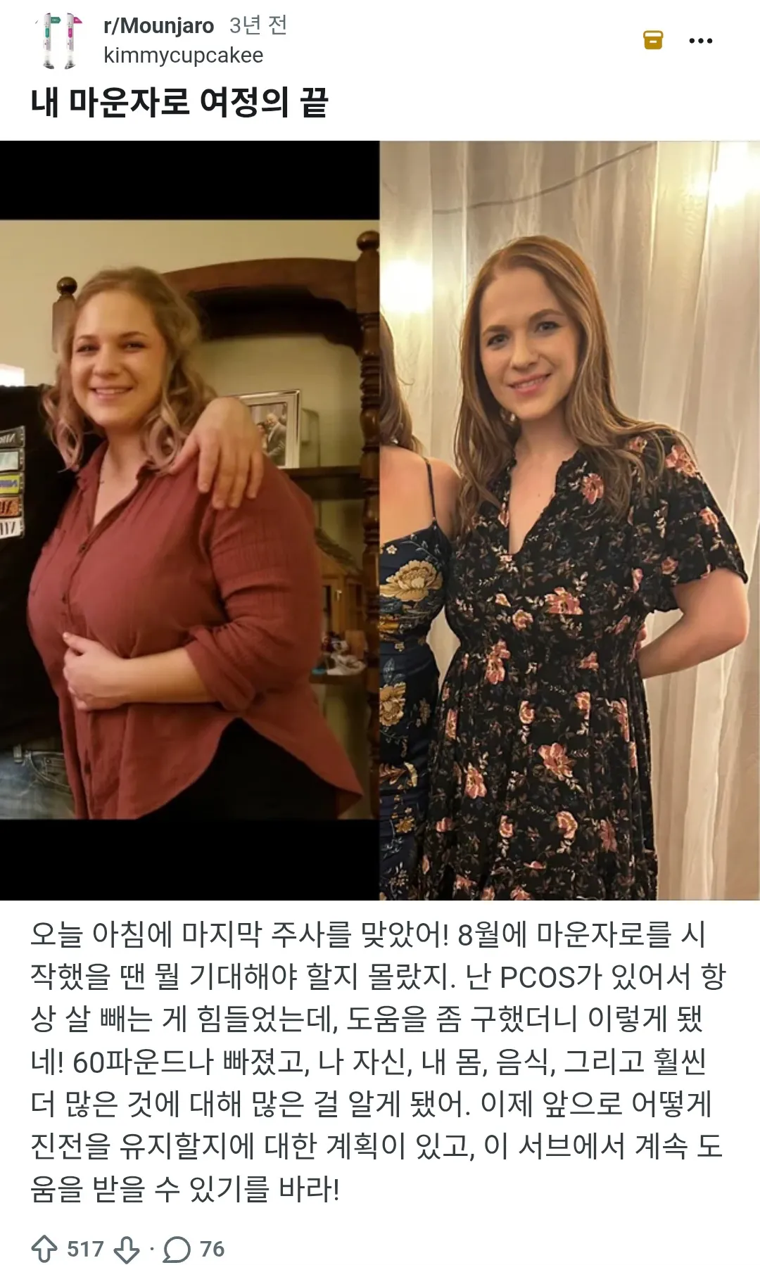 마운자로 ㄷㄷ2