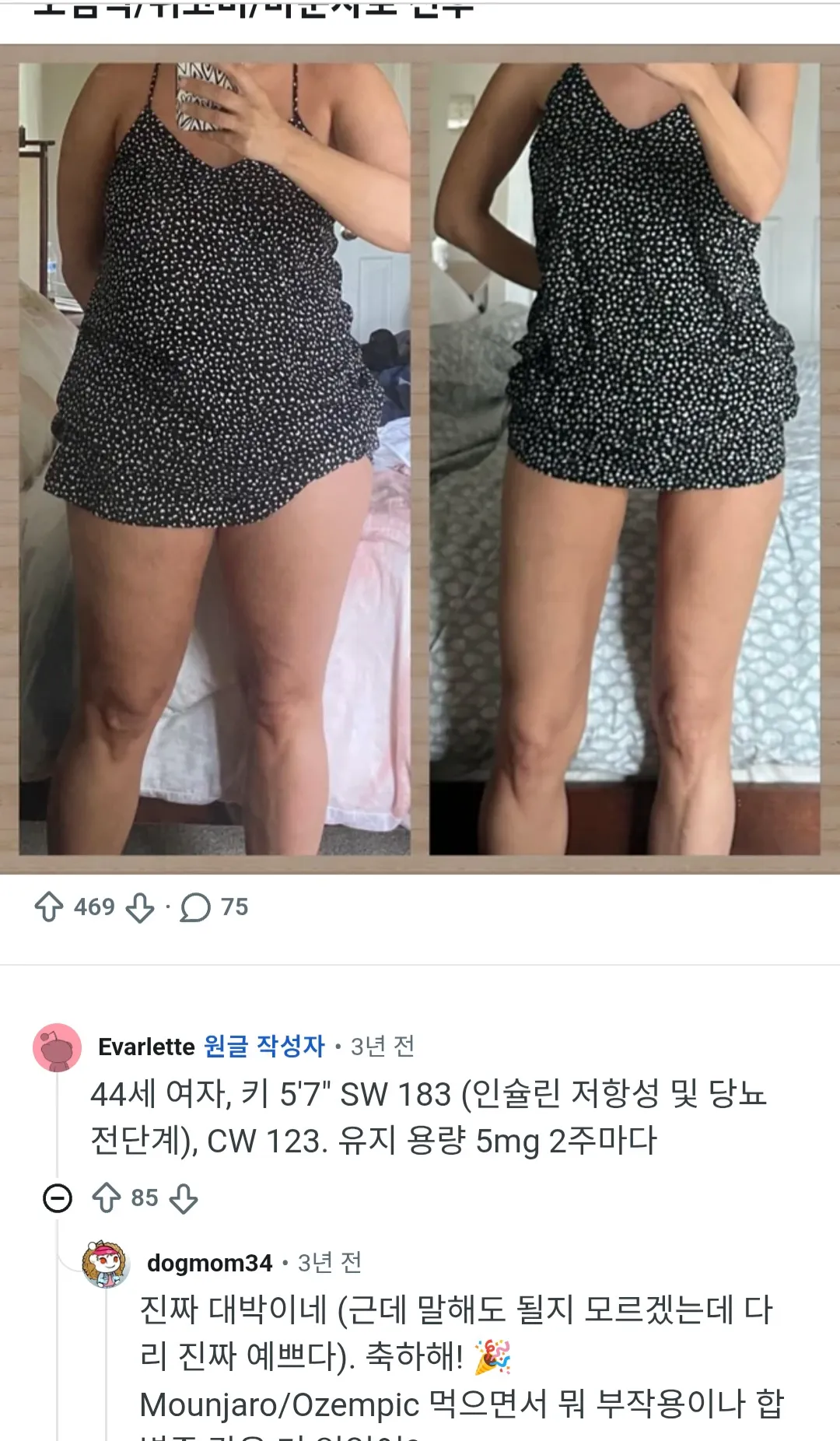 마운자로 ㄷㄷ3