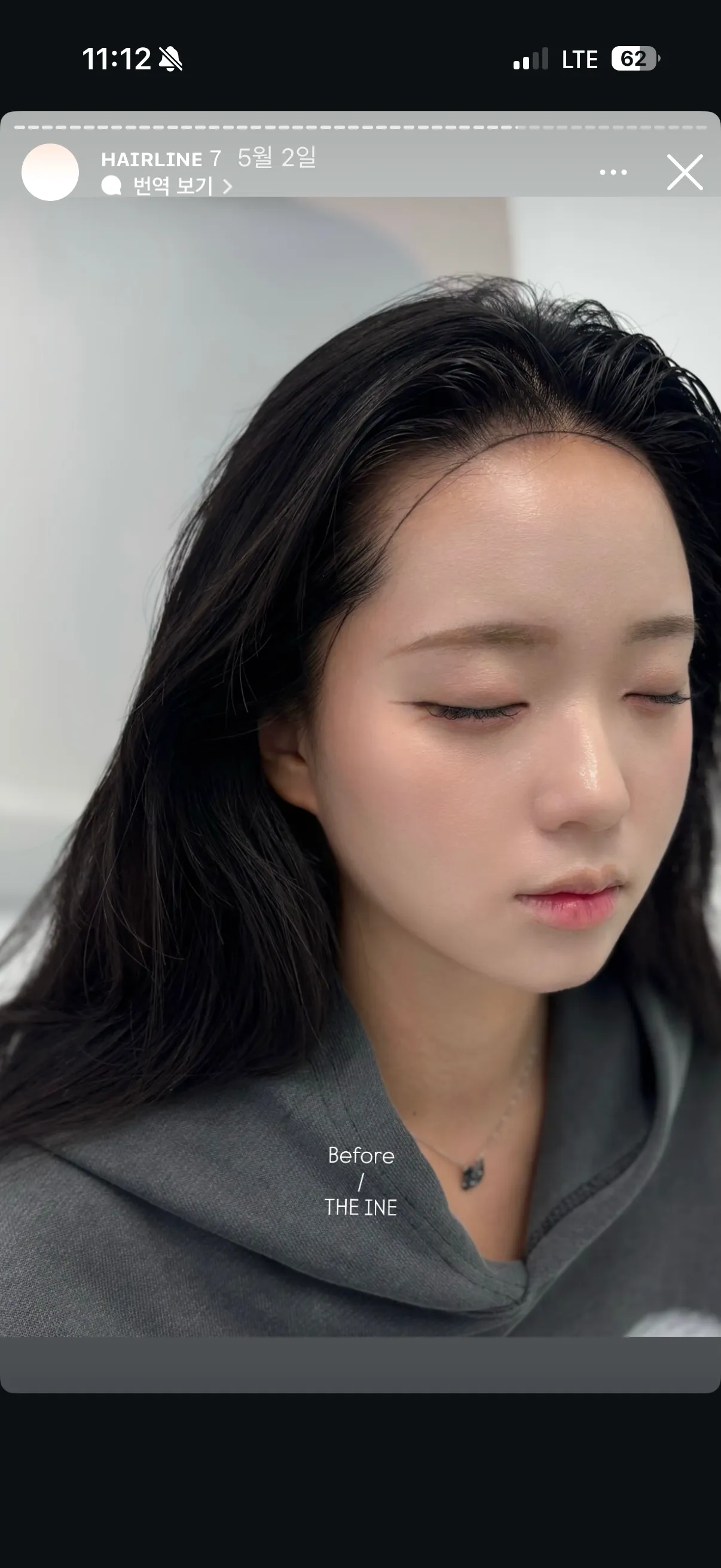 헤어라인 반영구 어디가 잘하는거같아요..?