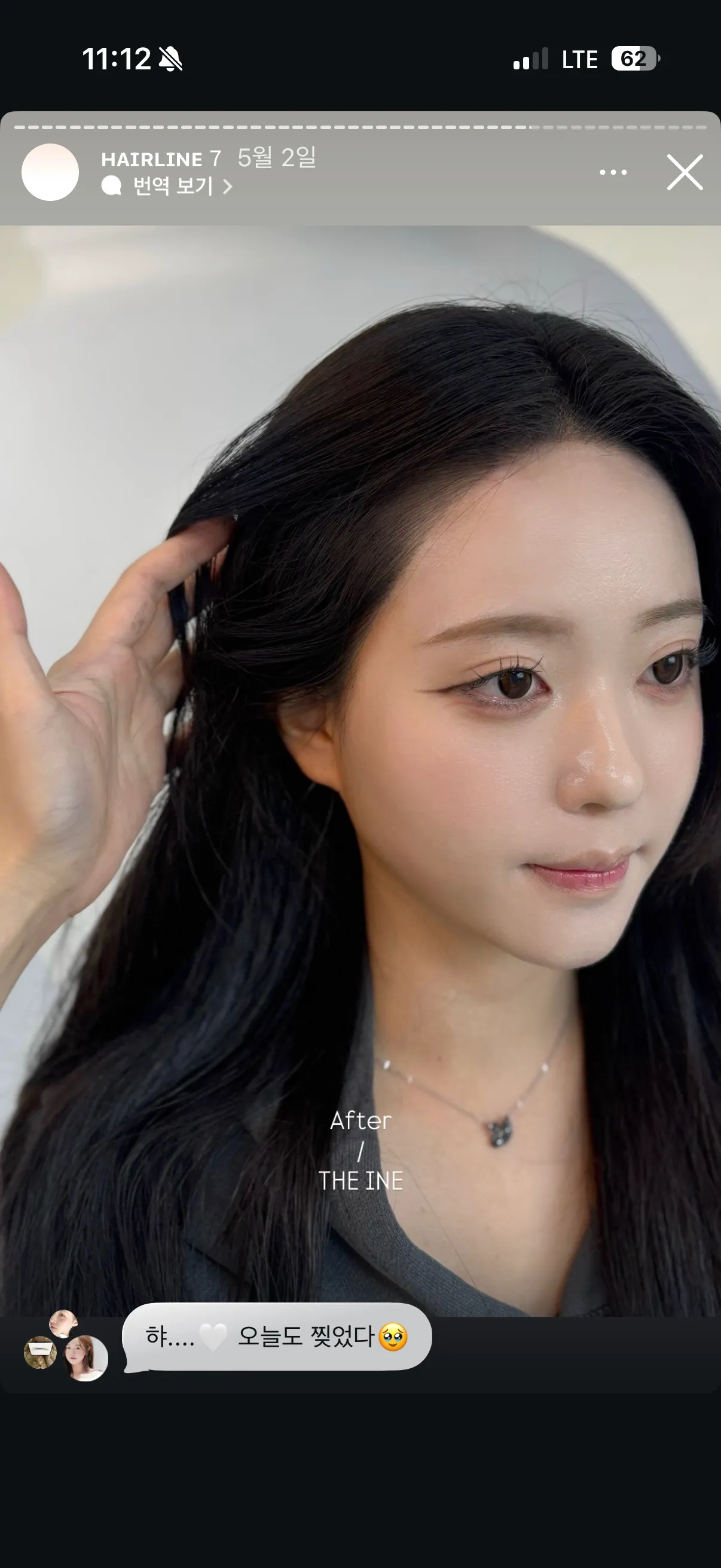 헤어라인 반영구 어디가 잘하는거같아요..?2