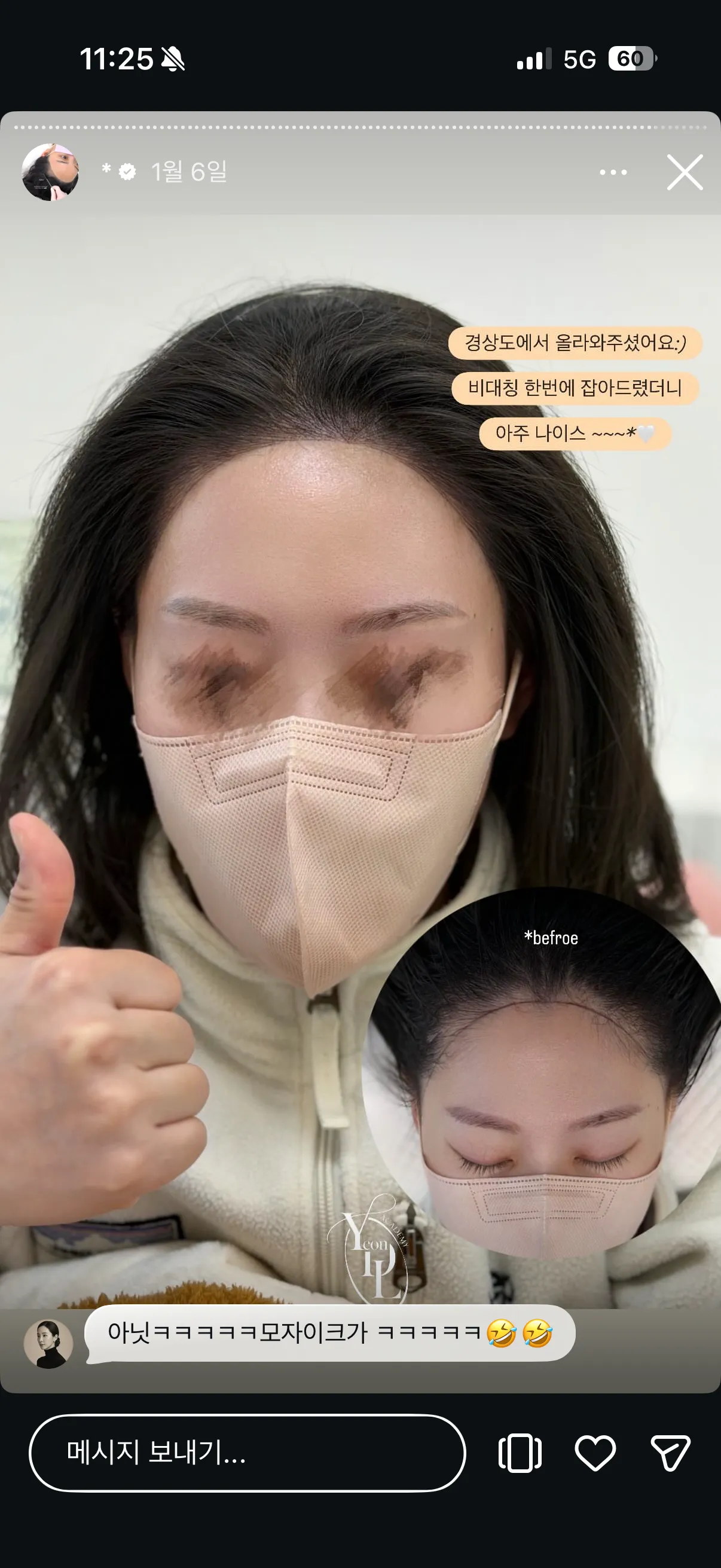 헤어라인 반영구 어디가 잘하는거같아요..?5