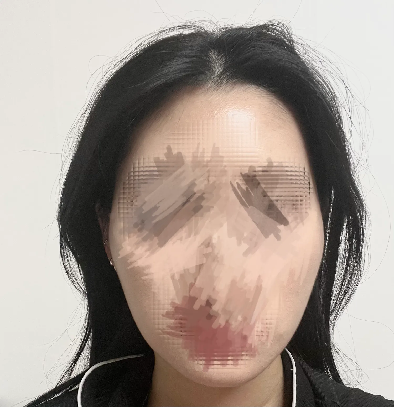 광대 쳐야겟죠???