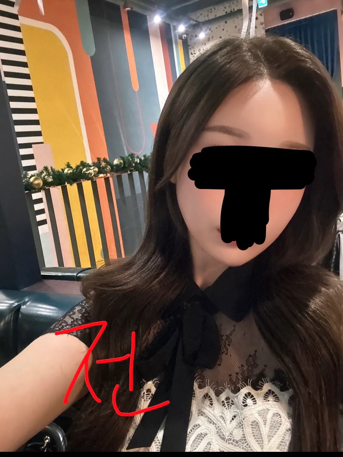 윤곽재수술 어때보여요??3