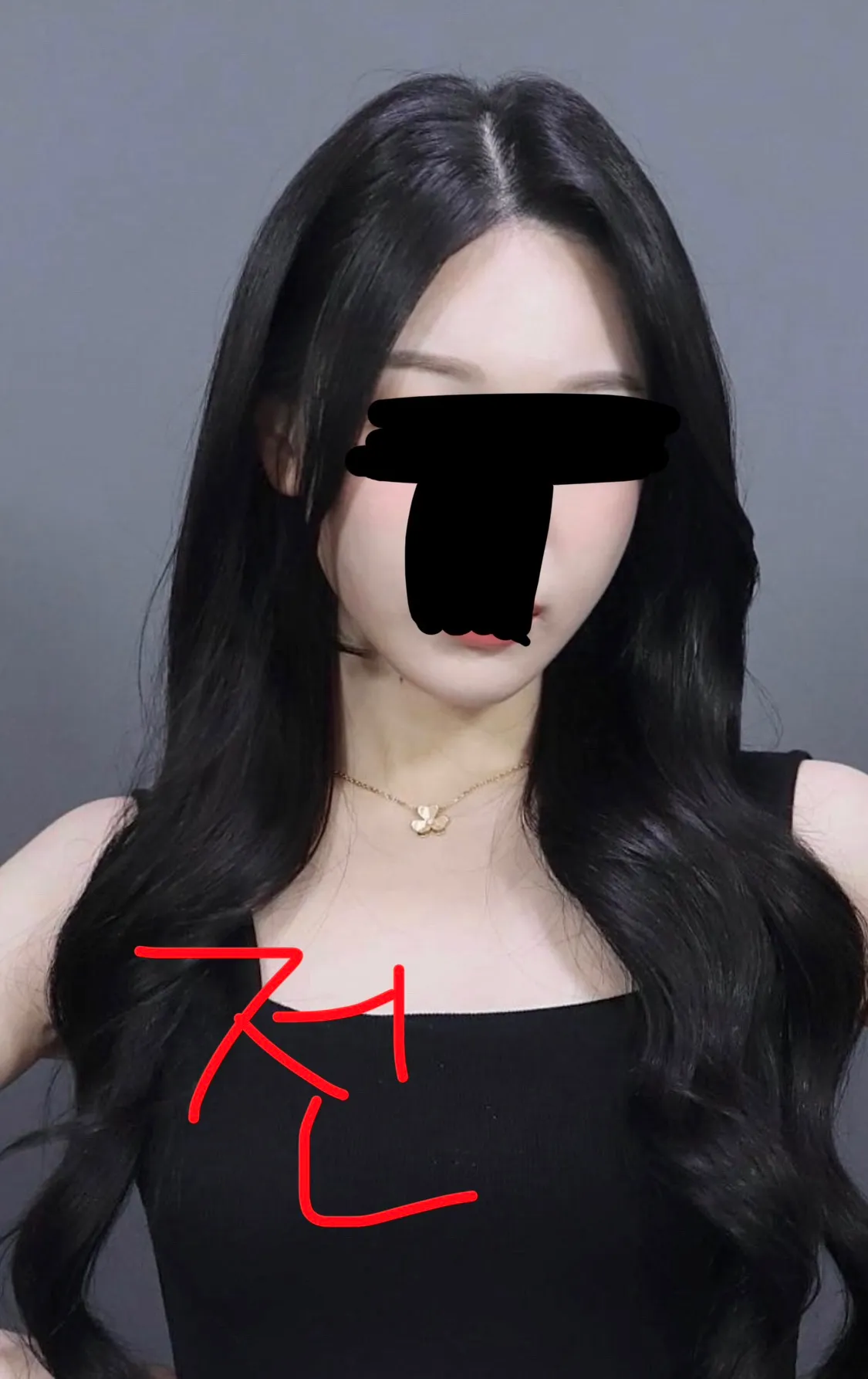 윤곽재수술 어때보여요??4