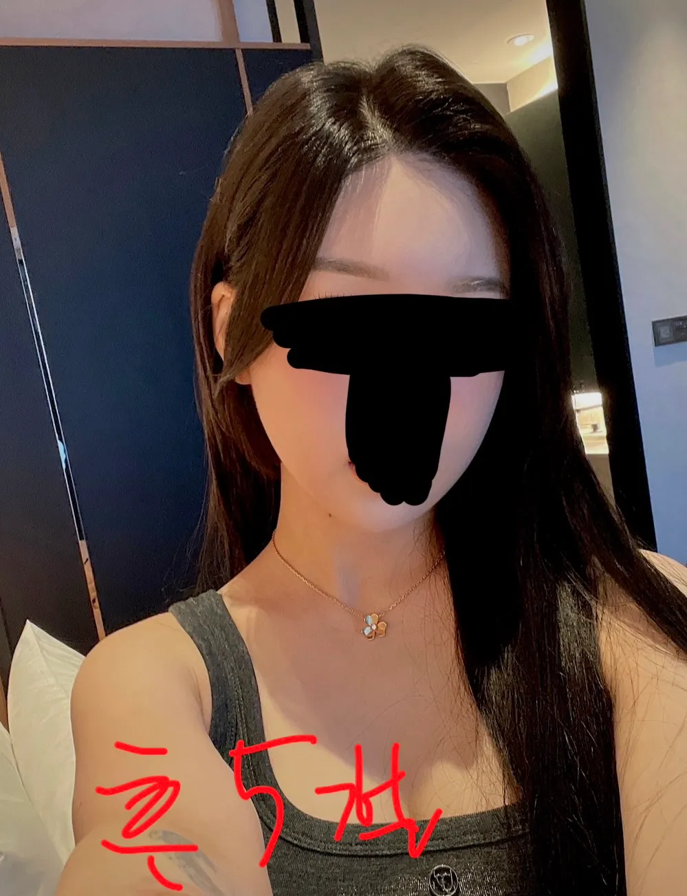 윤곽재수술 어때보여요??5