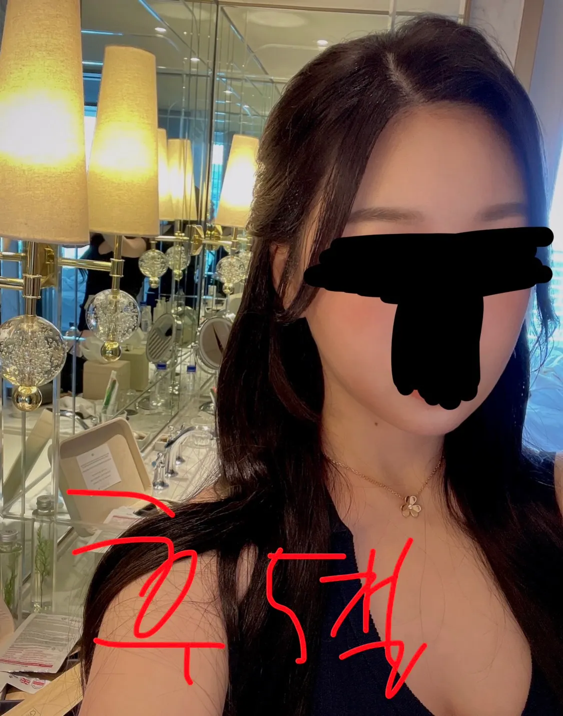 윤곽재수술 어때보여요??6