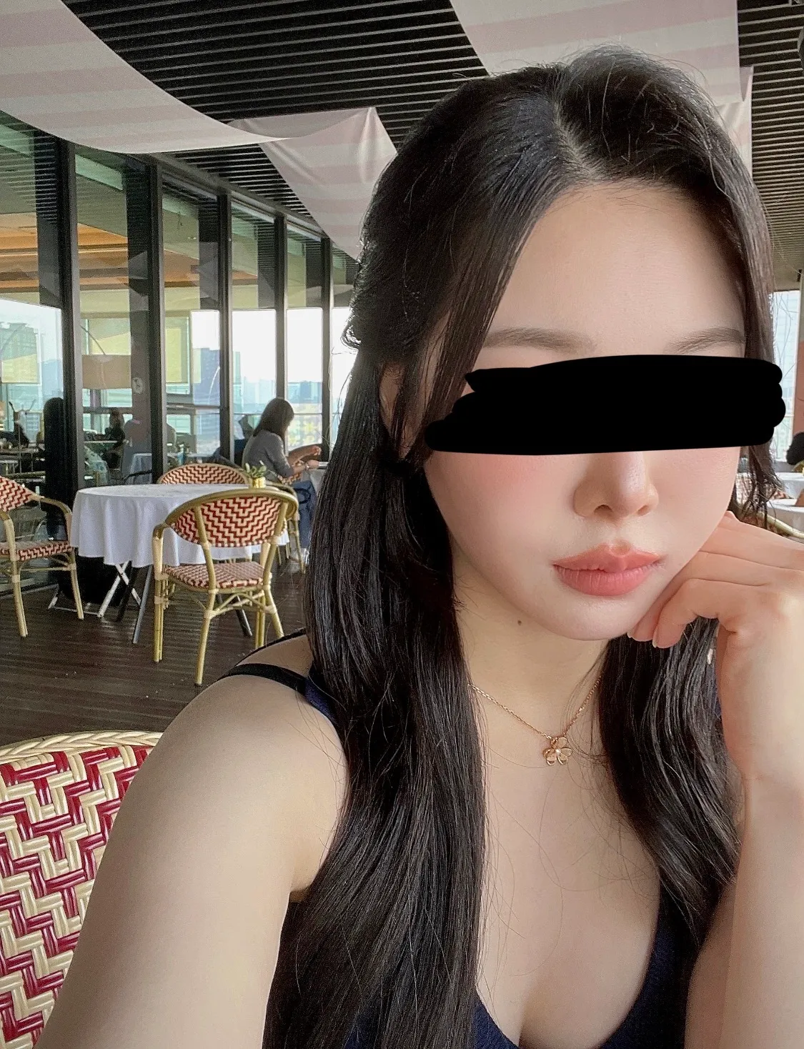 윤곽재수술 어때보여요?? 댓글 3